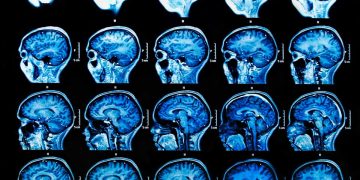 3 Ways Artificial Intelligence Will Change Healthcare